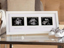 Pearhead Triple Sonogram Pregnancy Keepsake Frame, White